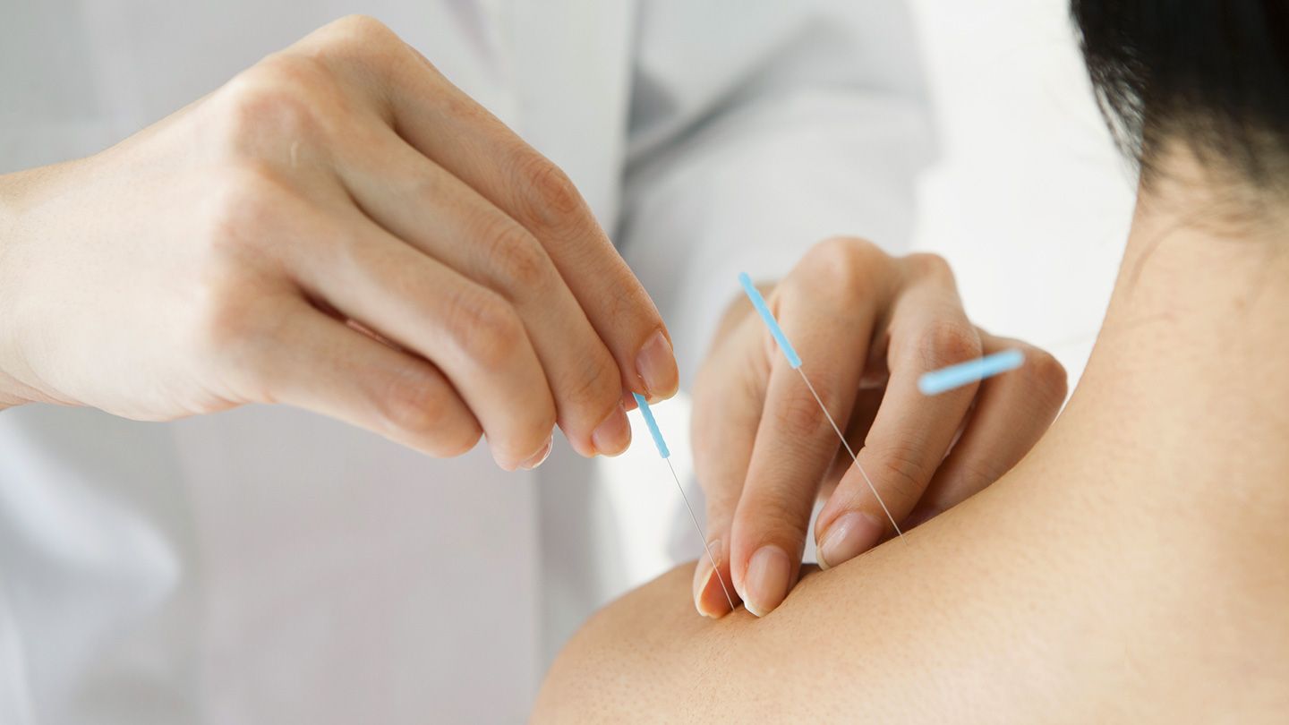 De nouvelles directives recommandent les meilleures utilisations de l'acupuncture, du massage et d'autres traitements non médicamenteux pour la douleur cancéreuse