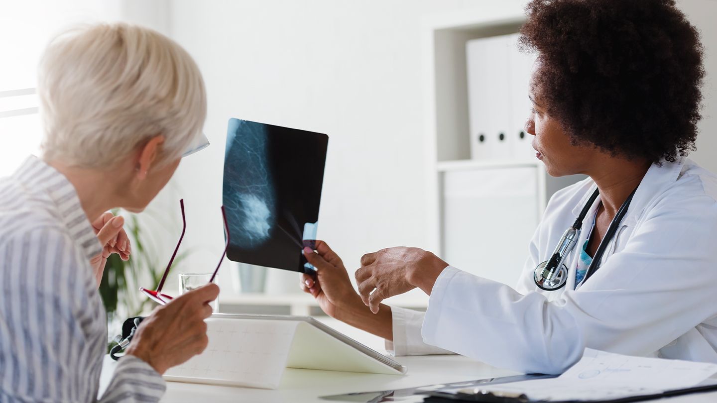 Des masses mammaires bénignes liées à un risque accru de cancer des années plus tard
