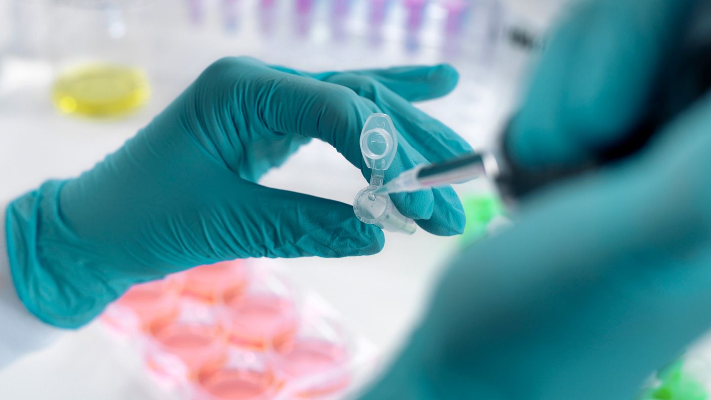 Un « patient de Düsseldorf » atteint du VIH guéri après une greffe de moelle osseuse