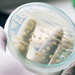 Les infections fongiques mortelles à Candida Auris sont en augmentation