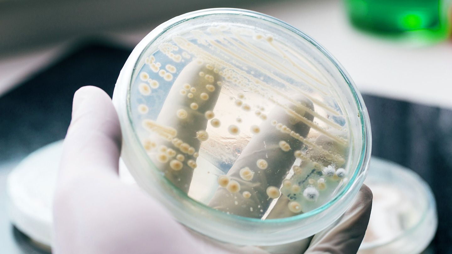 Les infections fongiques mortelles à Candida Auris sont en augmentation