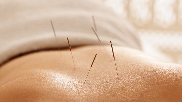 La santé sexuelle peut s'améliorer grâce aux traitements d'acupuncture