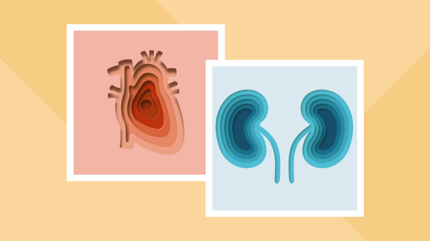 Le syndrome CKM, un trouble nouvellement identifié, augmente le risque de crise cardiaque