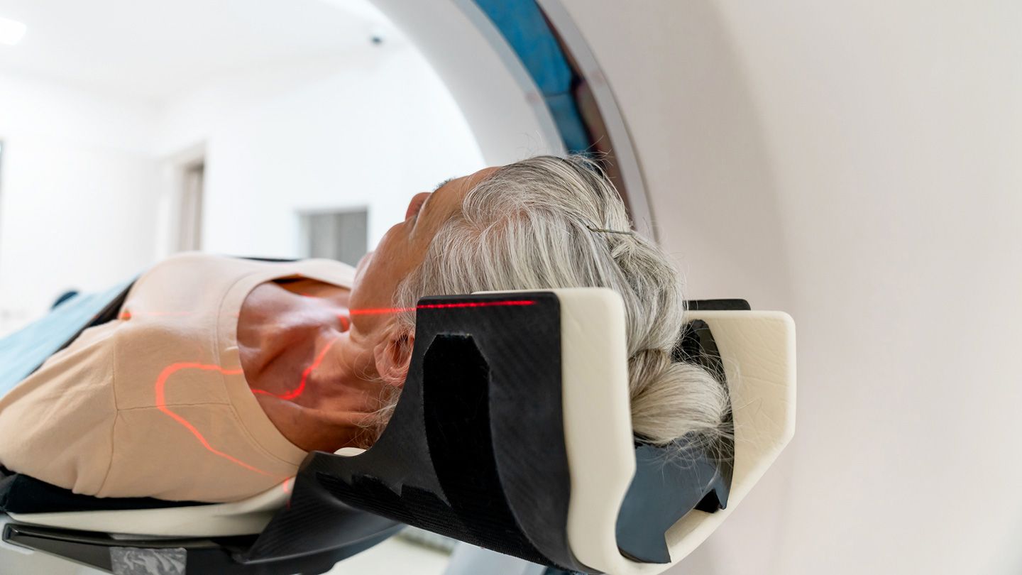 5 millions d'Américains supplémentaires devraient bénéficier d'un dépistage du cancer du poumon selon de nouvelles directives