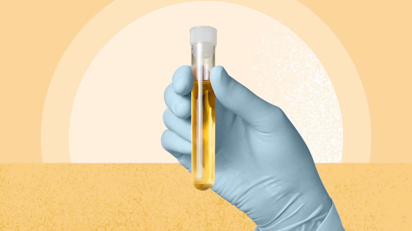 Pourquoi l'urine est jaune, selon une nouvelle étude