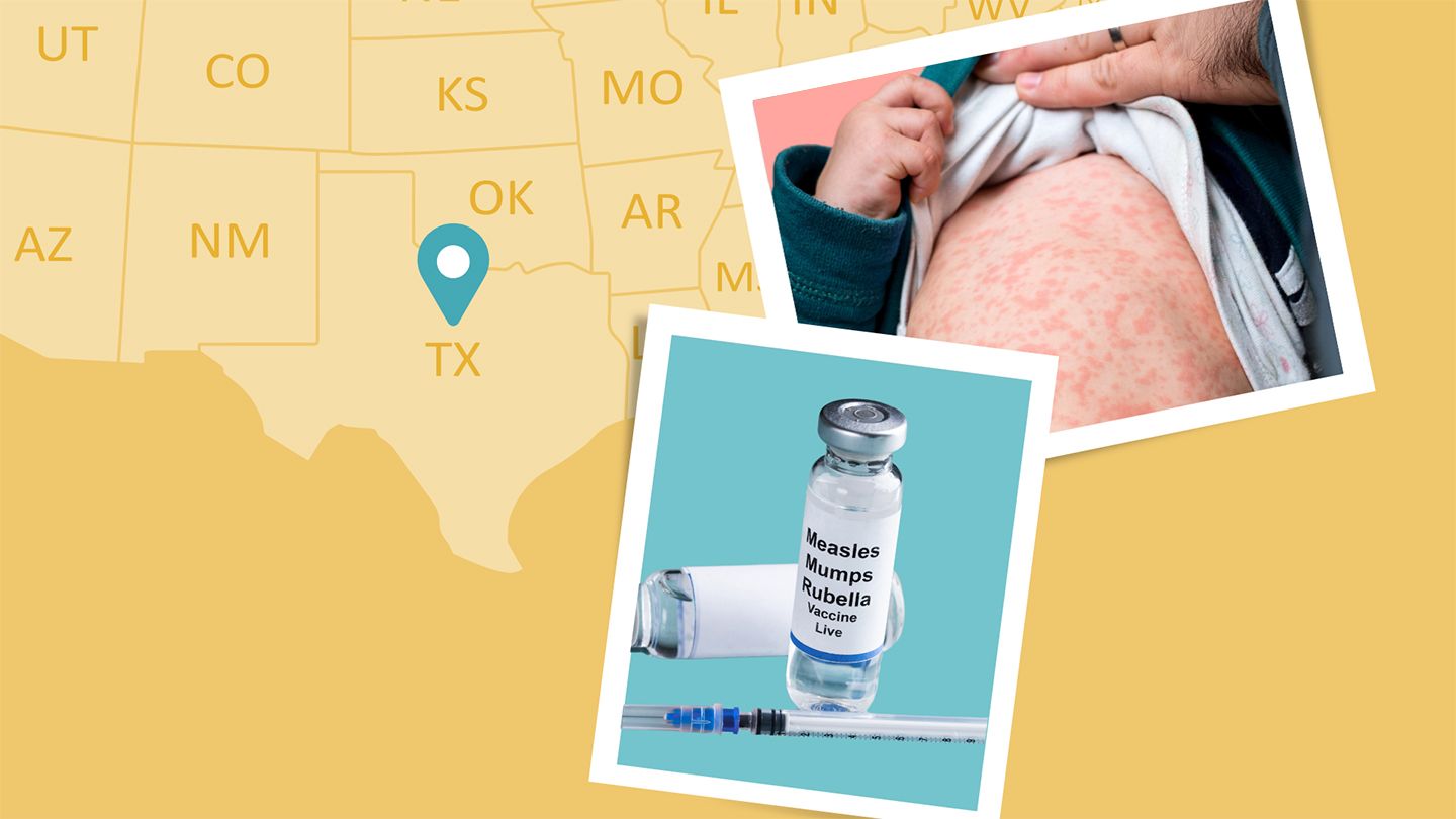 Major Measles Outbreak in Texas Could Be a Sign of Things to Come