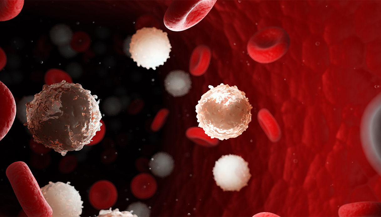 Immunothérapie et anticorps bispécifiques pour le cancer du sang, quand ils sont nécessaires et comment ils fonctionnent