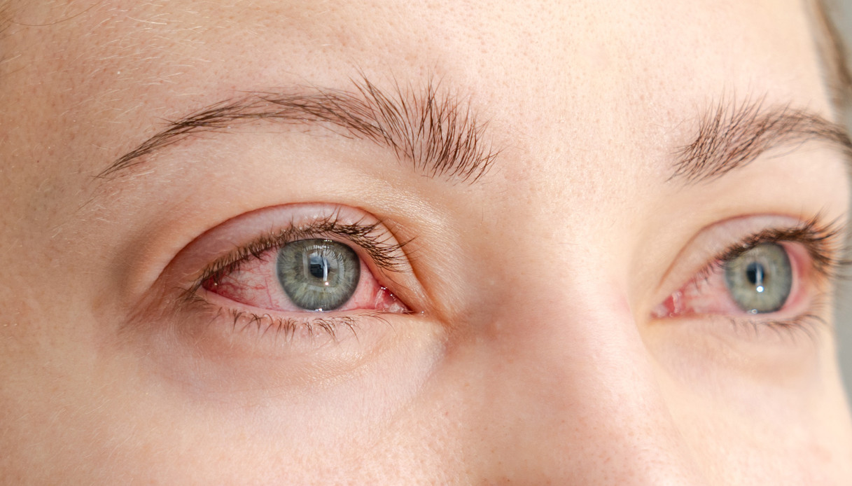 Spring and Eye bien-Being, comment gérer les allergies et la sécheresse oculaire