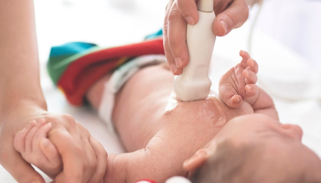 Nouveau-né de Gaza avec une tumeur de 2 kg opéré à Florence : elle va bien après la délicate opération de Meyer