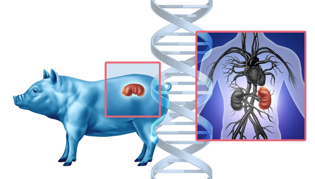 Première greffe de foie de porc : les espoirs d’une intervention innovante