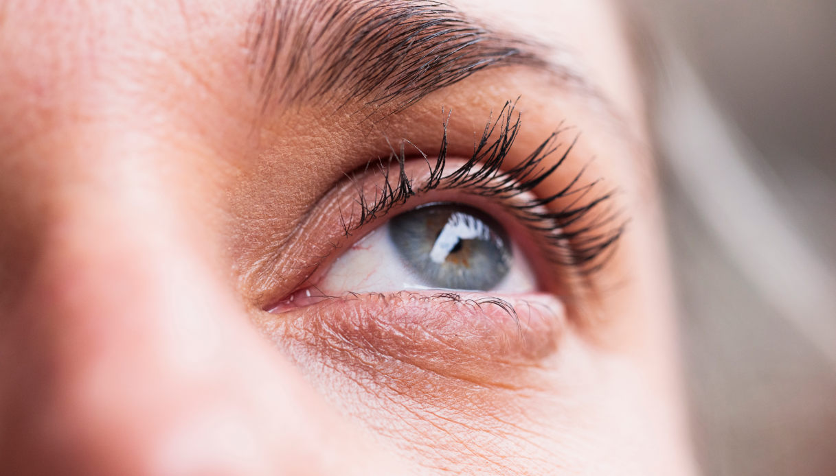 Rencontrez TED : La maladie thyroïdienne oculaire est racontée de première main