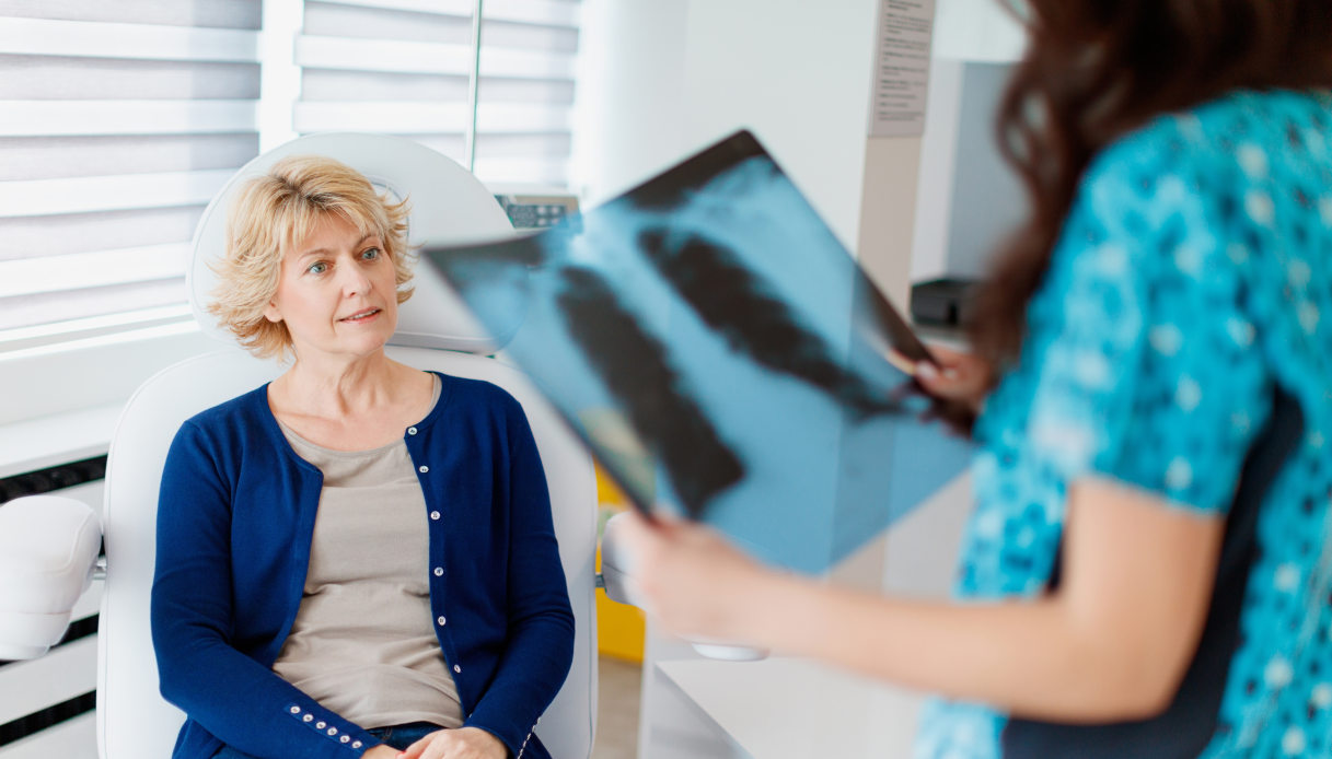 Cancer du poumon, qui est le plus à risque et traitements personnalisés