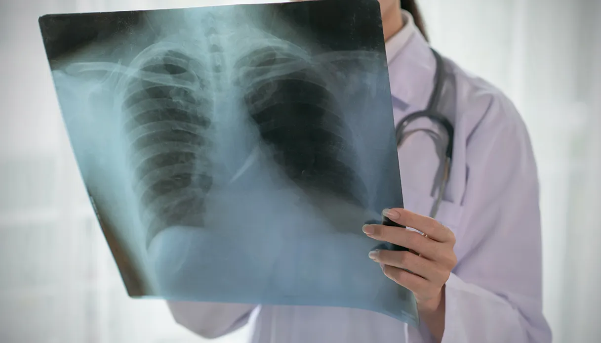 Microcytome, qu'est-ce que c'est et comment le reconnaître