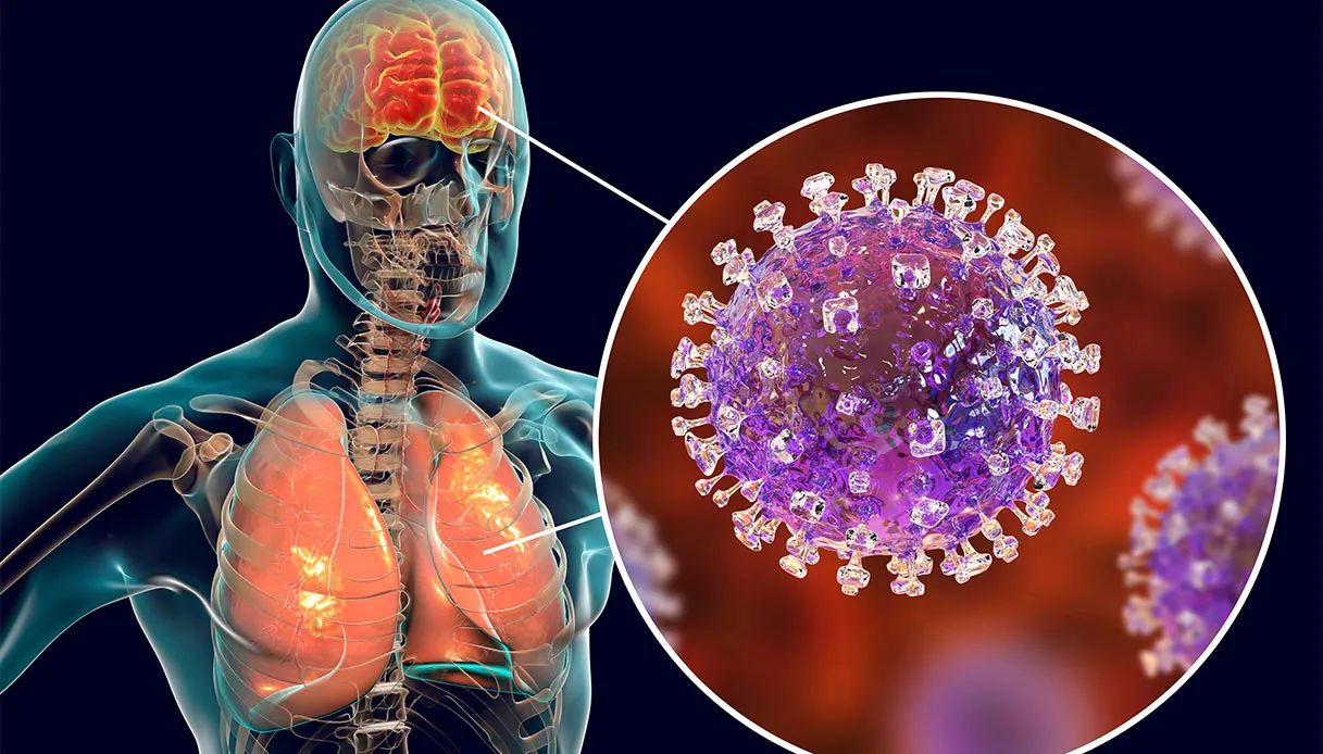 Virus Nipah, ce que nous savons de l’infection, comment elle se transmet, ce qu’elle provoque